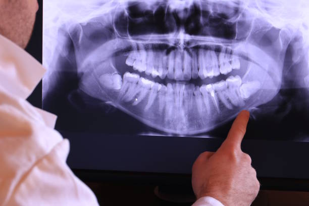 Best Emergency Root Canal Therapy in Flandreau, SD