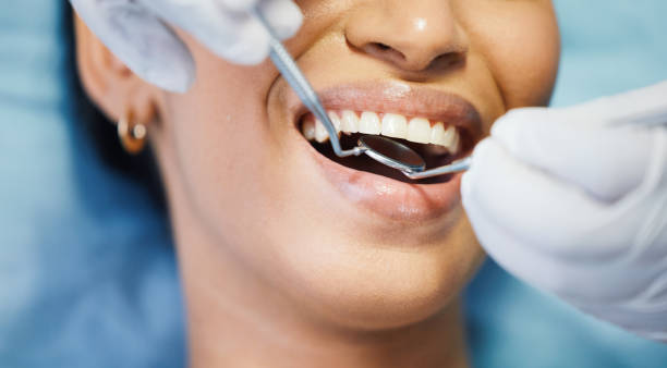 Best Emergency Dental Care for Sports Injuries in Flandreau, SD